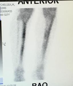 Not what you want to see. 